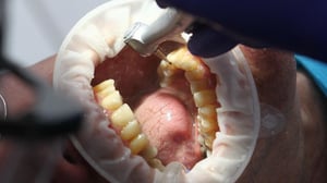 Is oral cancer is the ‘missing piece’ in the Government’s plan?