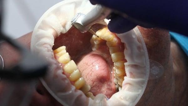 Is oral cancer is the ‘missing piece’ in the Government’s plan?