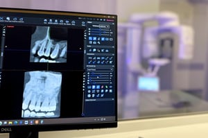 New dental CT scanner helps patients receive quicker diagnoses