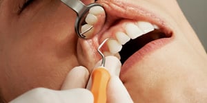 Dental practices moving out of NHS care