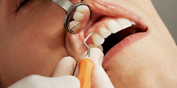 Dental practices moving out of NHS care